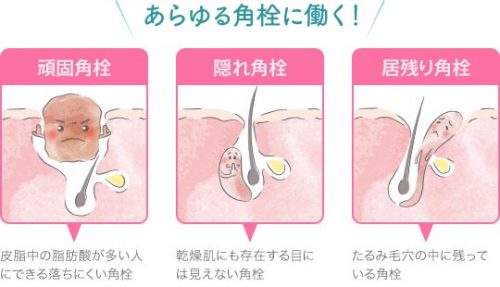 はねかける 一般 促進する マイクレ 角 栓 Takeda Kenchiku Jp